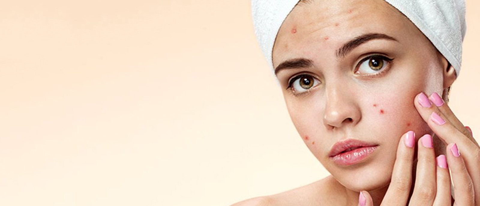 Acne and Scar Treatment